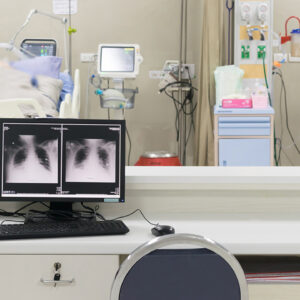 ICU Ventilators LCD-2020V Series